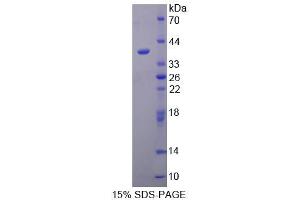Image no. 1 for TAF2 RNA Polymerase II, TATA Box Binding Protein (TBP)-Associated Factor, 150kDa (TAF2) (AA 918-1199) protein (T7 tag,His tag) (ABIN6238815)