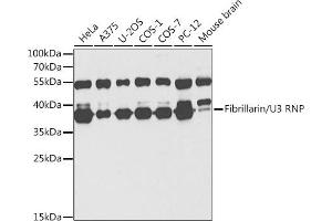 Fibrillarin Antikörper  (AA 100-321)