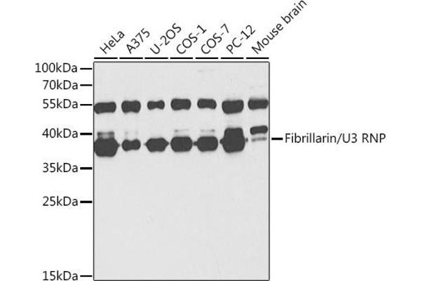 Fibrillarin Antikörper  (AA 100-321)