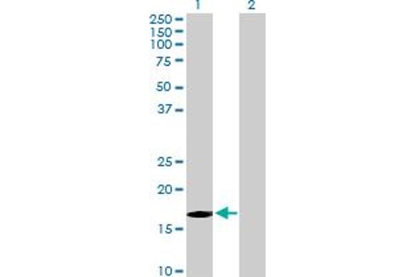 anti-F-Box and WD Repeat Domain Containing 5 (FBXW5) (AA 1-159) antibody