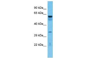 Image no. 1 for anti-TOX High Mobility Group Box Family Member 4 (TOX4) (C-Term) antibody (ABIN2780950)
