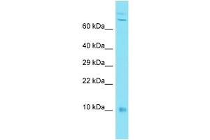anti-Chromosome 7 Open Reading Frame 49 (C7ORF49) (N-Term) antibody