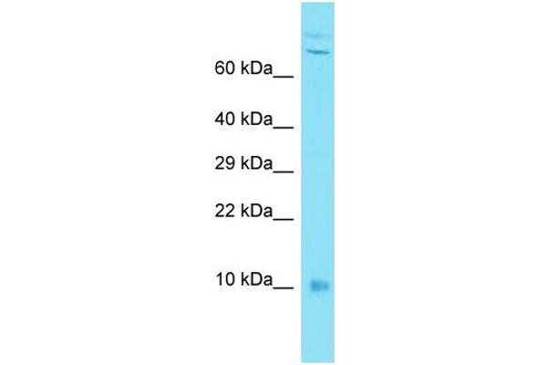 anti-Chromosome 7 Open Reading Frame 49 (C7ORF49) (N-Term) antibody