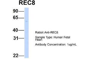 Image no. 2 for anti-REC8 Homolog (Yeast) (REC8) (N-Term) antibody (ABIN2783199)