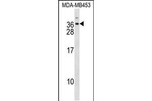 Image no. 1 for anti-Distal-Less Homeobox 6 (DLX6) (AA 91-119) antibody (ABIN5536289)