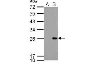 Bcl-2 anticorps  (N-Term)