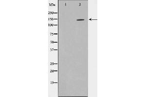 Image no. 1 for anti-Zinc Finger, MYND-Type Containing 8 (ZMYND8) (Internal Region) antibody (ABIN6264251)