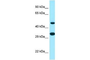 Image no. 1 for anti-Stearoyl-CoA Desaturase 5 (SCD5) (C-Term) antibody (ABIN2790026)