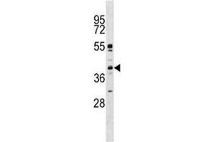 Image no. 1 for anti-Mitogen-Activated Protein Kinase 11 (MAPK11) (AA 133-161) antibody (ABIN3031828)