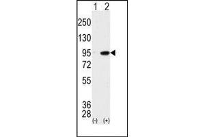 Image no. 2 for anti-Male Germ Cell-Associated Kinase (MAK) (C-Term) antibody (ABIN359695)