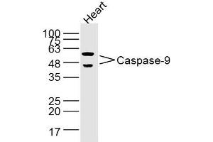 Image no. 2 for anti-Caspase 9, Apoptosis-Related Cysteine Peptidase (CASP9) (AA 271-314) antibody (ABIN724175)