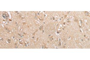 Immunohistochemistry of paraffin-embedded Human brain tissue using GCLC Polyclonal Antibody at dilution of 1:35(x200)