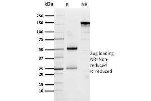 Image no. 1 for anti-Cathepsin D (CTSD) (AA 104-250) antibody (ABIN6939218)