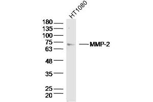Image no. 7 for anti-Matrix Metalloproteinase 2 (MMP2) (AA 31-109) antibody (ABIN668286)