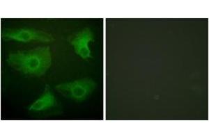 Immunofluorescence analysis of HeLa cells, using IkappaB-epsilon (Phospho-Ser22) Antibody.
