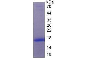 Image no. 1 for Platelet-Derived Growth Factor alpha Polypeptide (PDGFA) (AA 94-194) (Active) protein (His tag) (ABIN6239819)