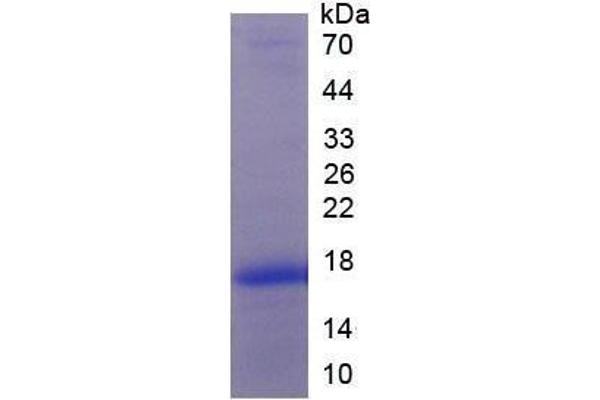 Platelet Derived Growth Factor Subunit A (PDGFA) (AA 94-194) (Active) protein (His tag)
