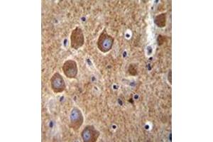 Image no. 3 for anti-P21-Activated Kinase 6 (PAK6) (AA 275-305), (Middle Region) antibody (ABIN953980)