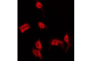 Image no. 3 for anti-Breast Cancer Metastasis Suppressor 1 (BRMS1) (N-Term) antibody (ABIN6256973)