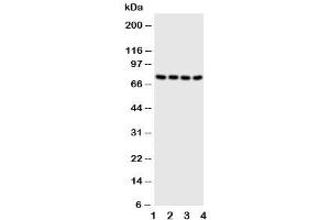 Western blot testing of PAK6 antibody and Lane 1:  HeLa