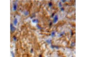Image no. 3 for anti-Neurotrophin 3 (NTF3) (AA 21-138) antibody (ABIN1172302)
