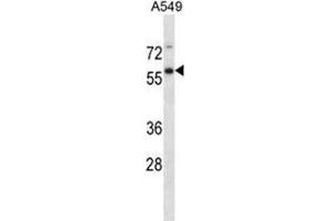 Image no. 1 for anti-Ubiquitin Specific Peptidase 30 (Usp30) (AA 155-185), (N-Term) antibody (ABIN955489)