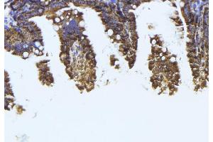 Image no. 3 for anti-Tubulin, beta 1 (TUBB1) antibody (ABIN6260254)