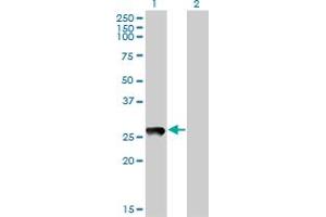 PRELID1 Antikörper  (AA 3-100)