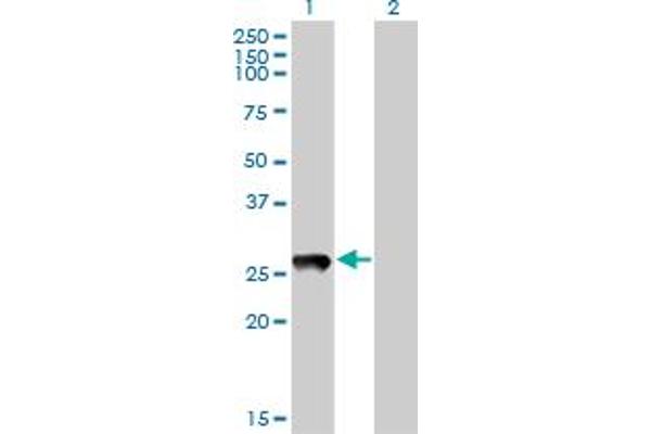PRELID1 Antikörper  (AA 3-100)