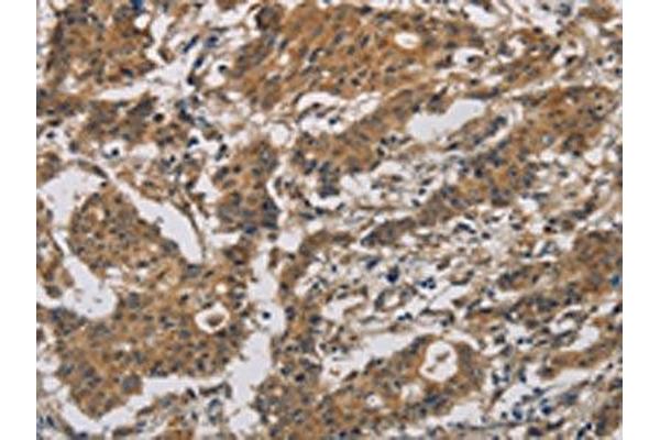 BCL2L12 antibody