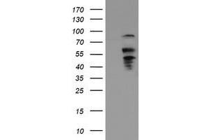 Image no. 2 for anti-UDP-GlcNAc:BetaGal beta-1,3-N-Acetylglucosaminyltransferase 2 (B3GNT2) antibody (ABIN1496799)