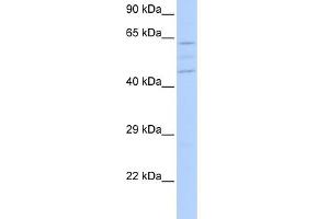 Image no. 1 for anti-Vacuolar Protein Sorting 37 Homolog A (VPS37A) (N-Term) antibody (ABIN2785169)