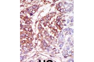 Image no. 1 for anti-Casein Kinase 1, gamma 3 (CSNK1G3) (AA 350-381), (C-Term) antibody (ABIN5530831)