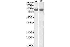Image no. 3 for anti-Vacuolar Protein Sorting 35 (VPS35) (C-Term) antibody (ABIN185182)