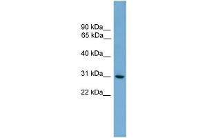 Image no. 2 for anti-Major Histocompatibility Complex, Class II, DQ alpha 2 (HLA-DQA2) (N-Term) antibody (ABIN2783759)