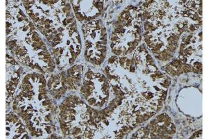 Image no. 3 for anti-Transforming, Acidic Coiled-Coil Containing Protein 3 (TACC3) (C-Term) antibody (ABIN6258335)