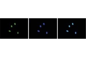 Image no. 3 for anti-Histone Cluster 1, H3a (HIST1H3A) (2meArg17 (asymetric)), (acLys18) antibody (ABIN5773856)