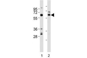 Image no. 3 for anti-SRY (Sex Determining Region Y)-Box 11 (SOX11) (AA 103-132) antibody (ABIN3032722)