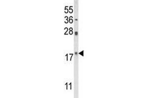 Image no. 3 for anti-Peptidylprolyl Cis/trans Isomerase, NIMA-Interacting 1 (PIN1) (AA 30-56) antibody (ABIN3028920)