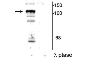 Image no. 1 for anti-Protein tyrosine Phosphatase, Non-Receptor Type 3 (PTPN3) (pSer459) antibody (ABIN6254111)
