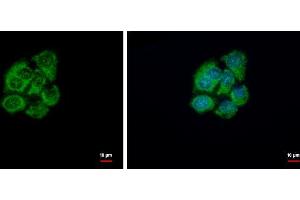 Image no. 2 for anti-Glutathione Transferase zeta 1 (Maleylacetoacetate Isomerase) (GSTZ1) (Center) antibody (ABIN2856258)
