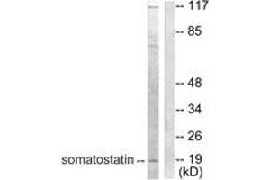 Image no. 1 for anti-Somatostatin (SST) (AA 10-59) antibody (ABIN1533402)