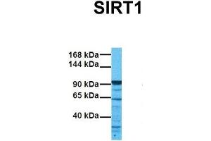 Image no. 2 for anti-Sirtuin 1 (SIRT1) (N-Term) antibody (ABIN2779607)