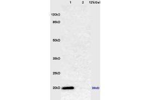 Image no. 3 for anti-Caveolin 1, Caveolae Protein, 22kDa (CAV1) (AA 2-120) antibody (ABIN686752)
