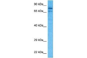 Image no. 1 for anti-PRP3 Pre-mRNA Processing Factor 3 Homolog (PRPF3) (C-Term) antibody (ABIN5517267)