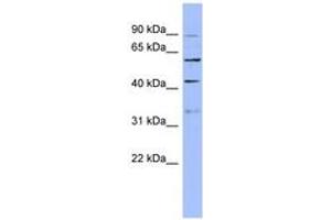 Image no. 1 for anti-PRP4 Pre-mRNA Processing Factor 4 Homolog (PRPF4) (AA 71-120) antibody (ABIN6742987)