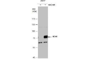 WB Image BCHE antibody detects BCHE protein by western blot analysis.