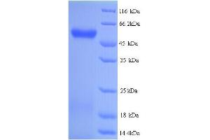Image no. 1 for Hyaluronidase-2 (HYAL2) (AA 21-448) protein (His tag) (ABIN5714322)