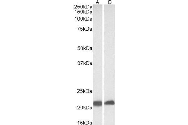 Caveolin 3 antibody  (N-Term)