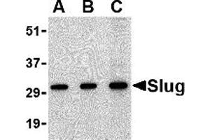 Western Blotting (WB) image for anti-SLUG (Middle Region 2) antibody (ABIN1031203)